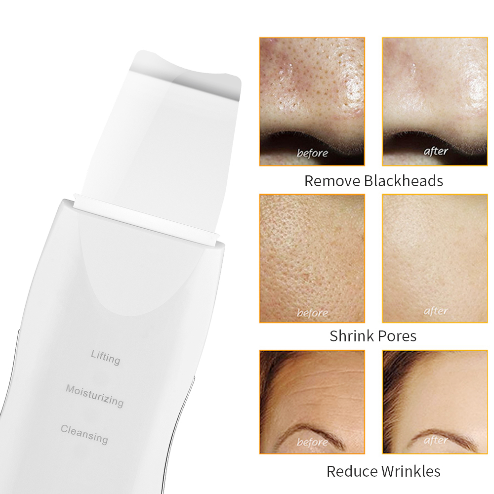 Miniatura 4 de Limpiador Facial 3 en 1 Acné espinillas